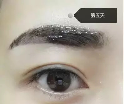 10.png