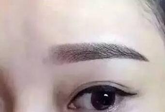 水雾眉价位