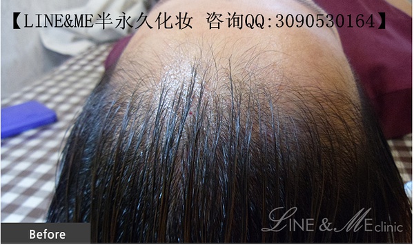 做半永久发际线要注意什么！