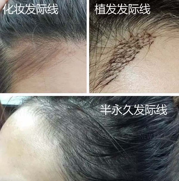 不挨刀童颜又瘦脸,女神竟都靠它