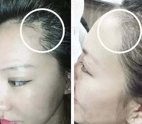 不挨刀童颜又瘦脸,女神竟都靠它