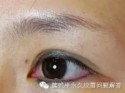 普通眼线