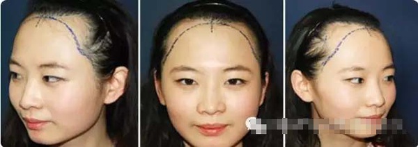 不挨刀童颜又瘦脸,女神竟都靠它