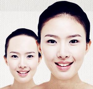 发际线调整，让你比韩剧女明星还美腻！