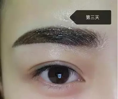 9.png