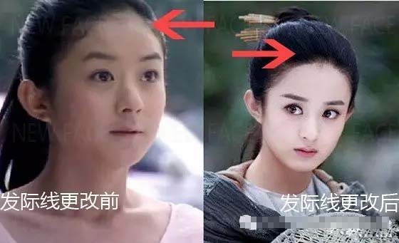 不挨刀童颜又瘦脸,女神竟都靠它