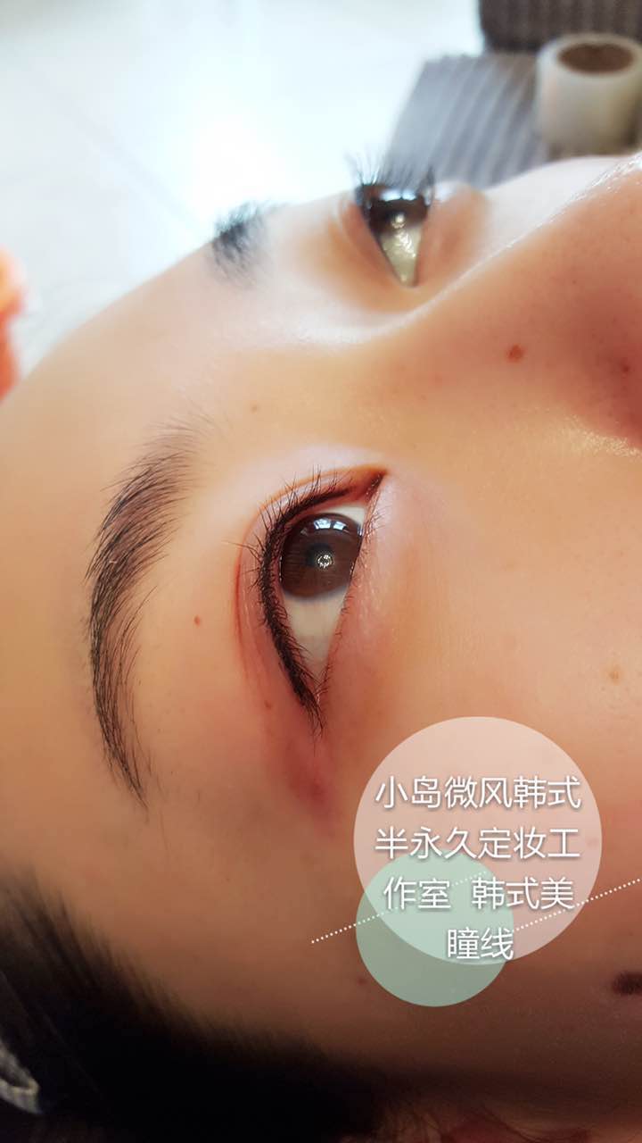 鹤壁发际线